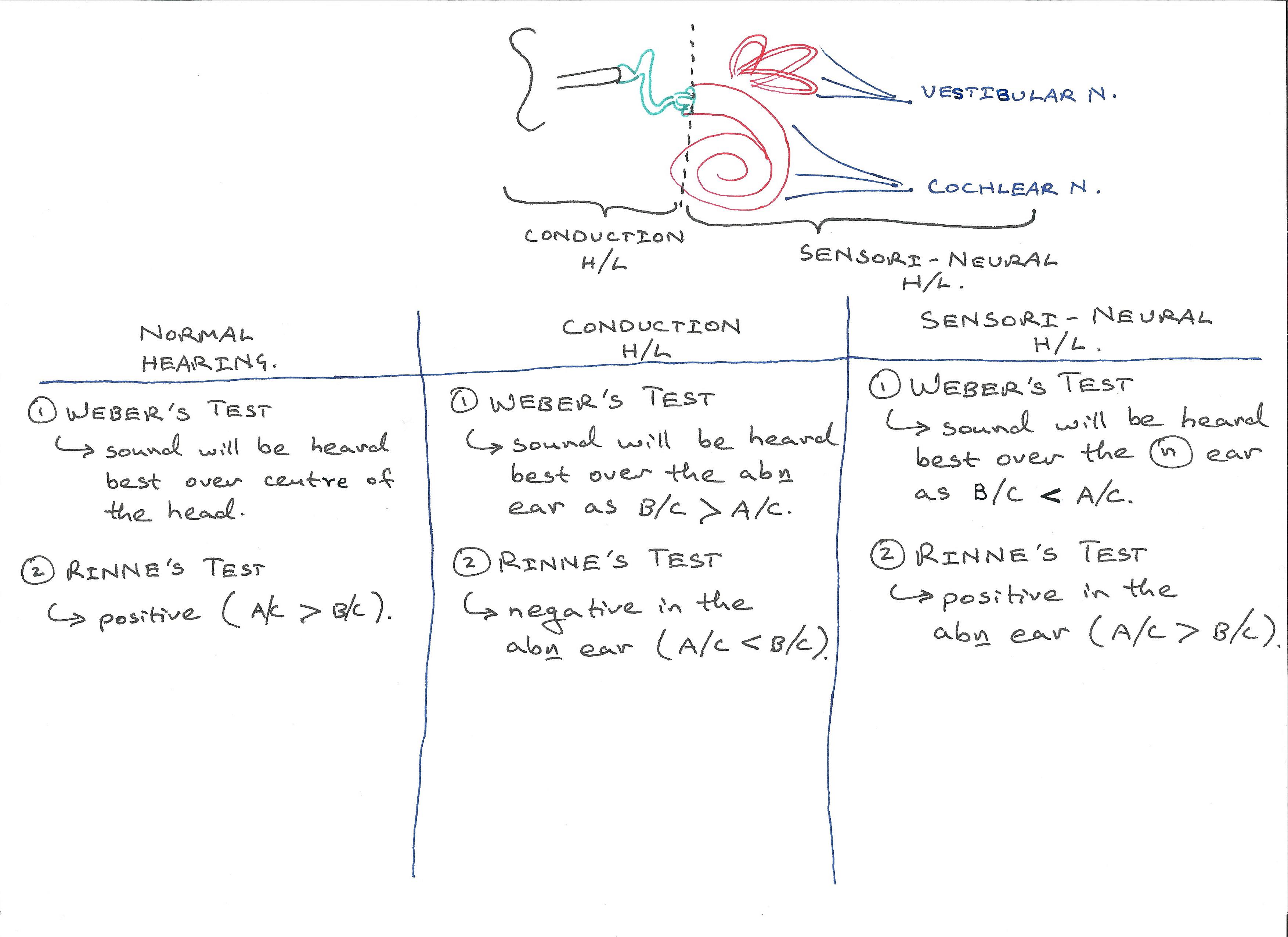 Weber and Rinne Tests.jpg