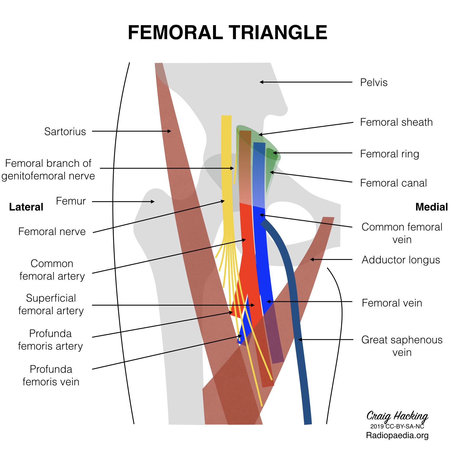 Femoral-triangle-diagram.jpeg